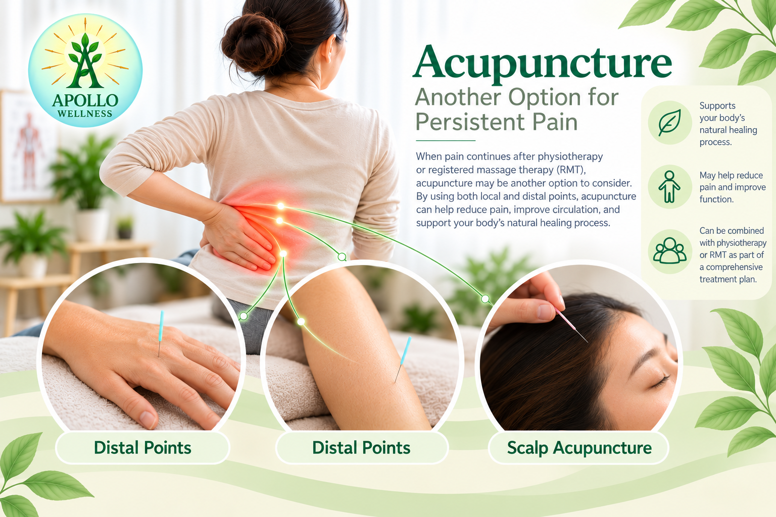 Apollo Wellness educational graphic: Acupuncture—Another Option for Persistent Pain, showing lower-back discomfort with distal hand and leg points and scalp acupuncture, and notes that care may support natural healing, help reduce pain, and can be combined with physiotherapy or RMT.